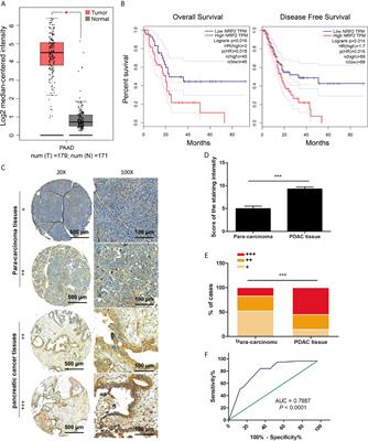 N2E4, a Monoclonal Antibody Targeting Neuropilin-2, Inhibits Tumor Growth and Metastasis in Pancreatic Ductal Adenocarcinoma via Suppressing FAK/Erk/HIF-1α Signaling